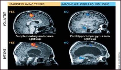 What Happened To Terri Schiavo Brain? Autopsy Reveal And Documentary Details